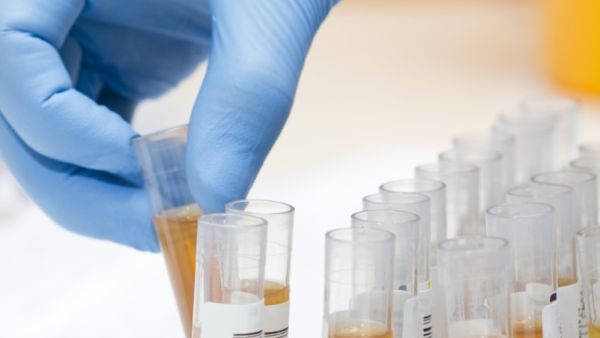 Eine Person steckt, mit einer blau behandschuhten Hand, ein mit urinfarbener (oben), klarer(mittig) und dunkelroter (unten) Flüssigkeit gefülltes Reagenzglas zu anderen in eine Halterung. Alle weisen einen Schiftcodeaufkleber auf.